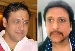 Govinda Hair Transplant Before and After