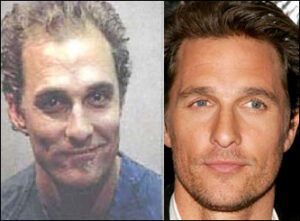 Matthew McConaughey hair transplant