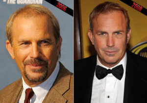 kevin-costner-hair-transplant