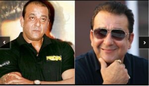 Sanjay Dutt Hair Transplant