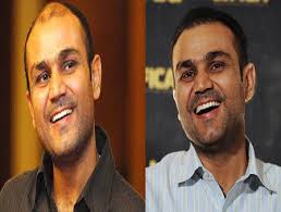 virendra sehwag hair transplant