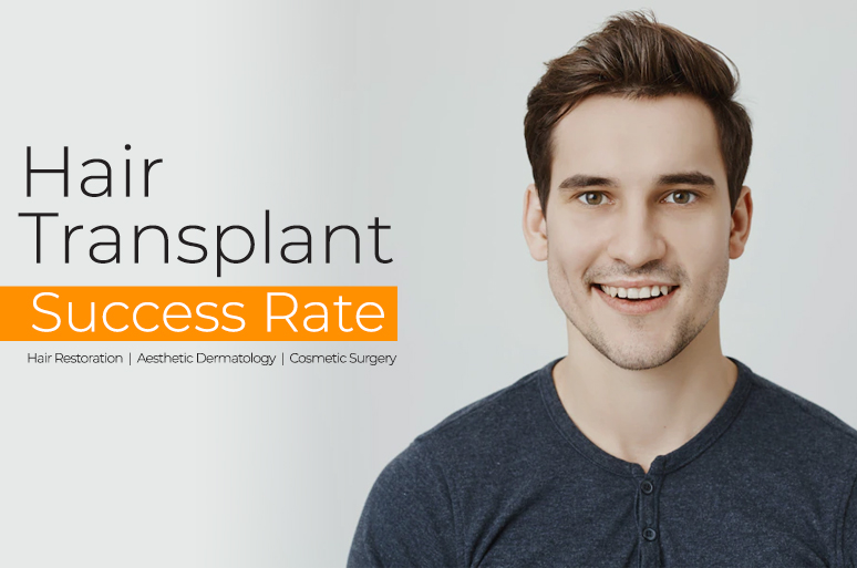 Hair Transplant Success Rate in India