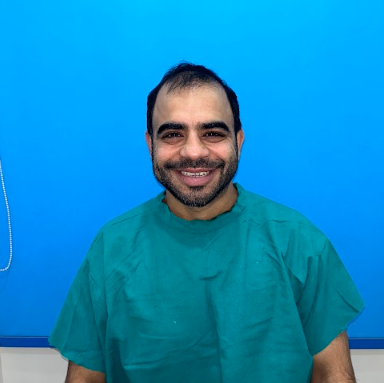 Before hair transplant at AK Clinics