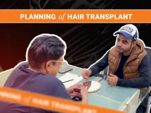 Planning a Hair Transplant